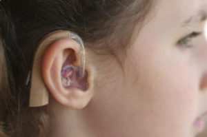 Girl with a hearing aid